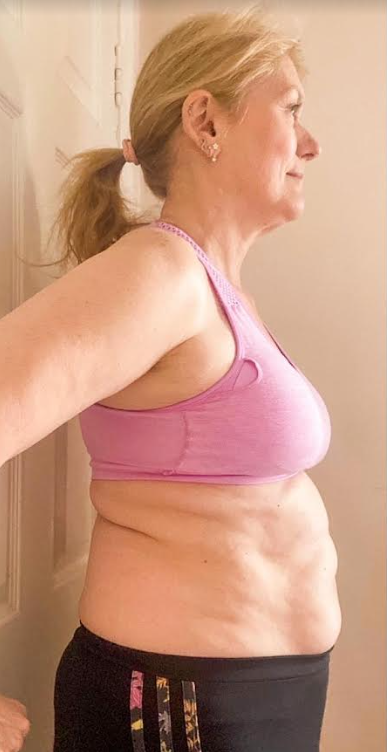 testimonial-before