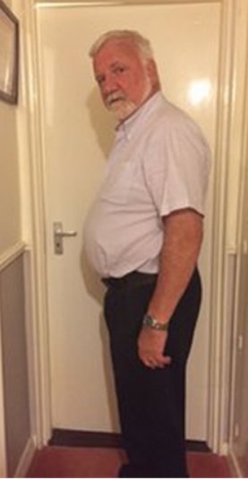 testimonial-before