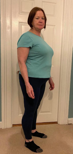 testimonial-before