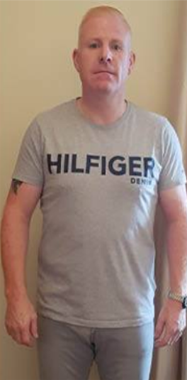 testimonial-after