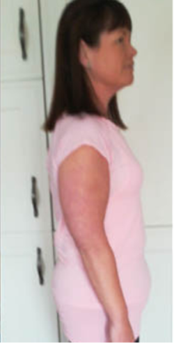 testimonial-after