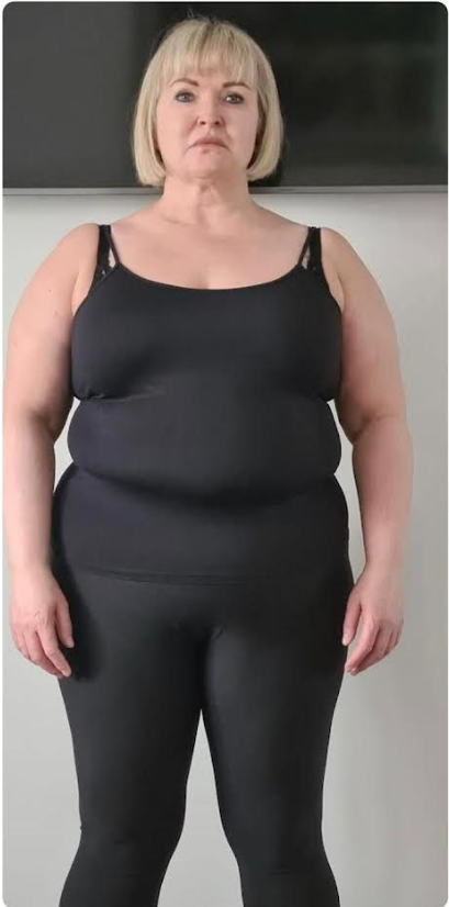 testimonial-before
