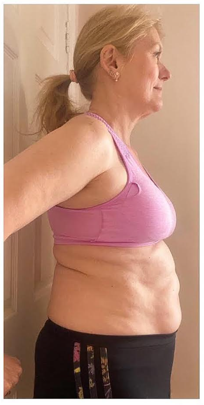 testimonial-before