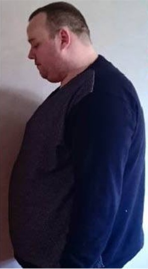 testimonial-before