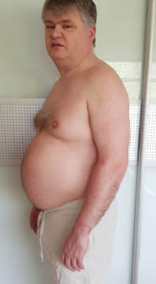 testimonial-before