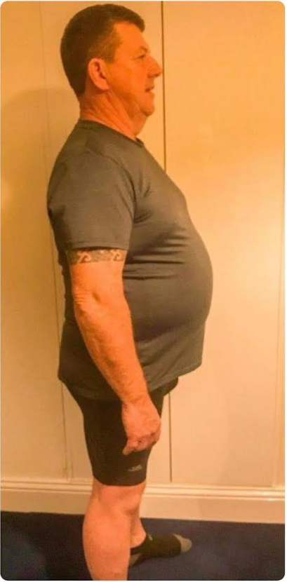 testimonial-before